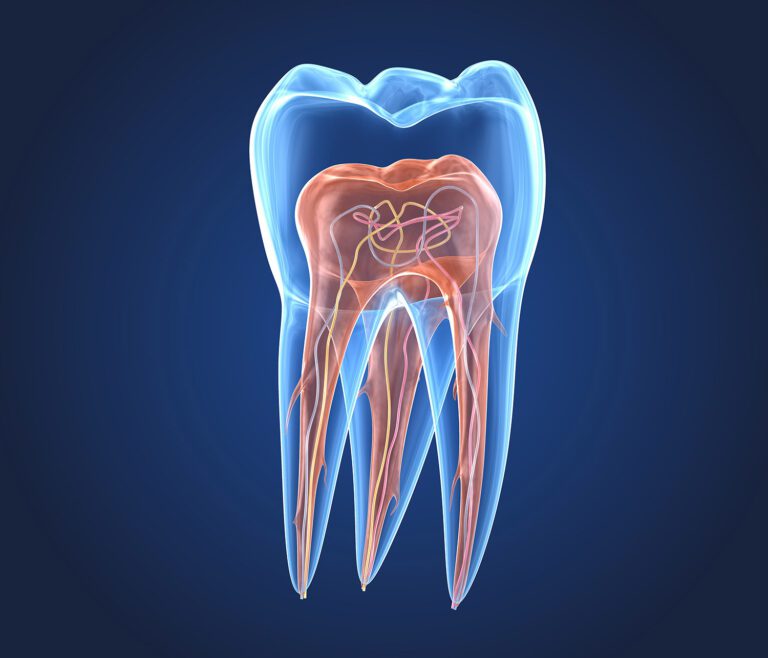 traitement endodontie