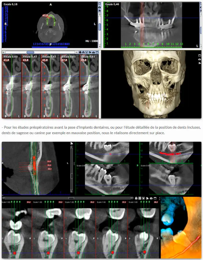 dental scanner
