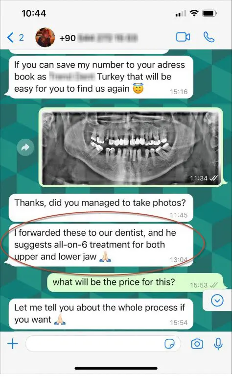 Dental implant in Turkey